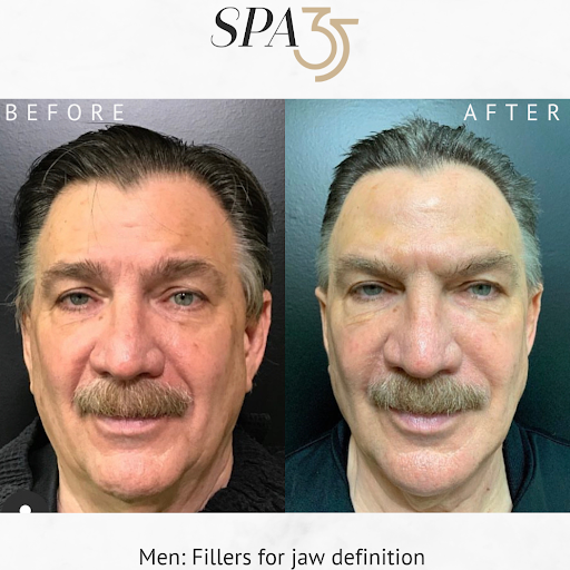 Explore eeyore tattoo ideas, creative tattoo ideas in Boise, available at Spa 35 Med Spa