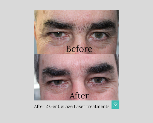 Laser Hair Removal Service «Smooth Skin Laser», reviews and photos, 2013 Woodbrook Ct, Charlottesville, VA 22901, USA