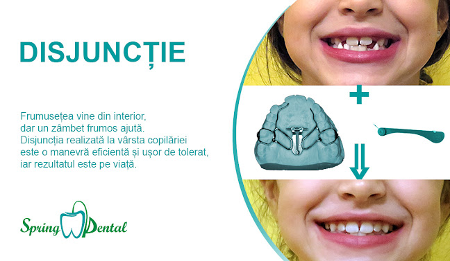 orar Spring Dental - Stomatologie Sector 4