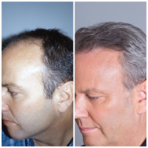 Hair Transplantation Clinic «Bosley Medical - Long Island», reviews and photos, 324 S Service Rd Suite 122, Melville, NY 11747, USA