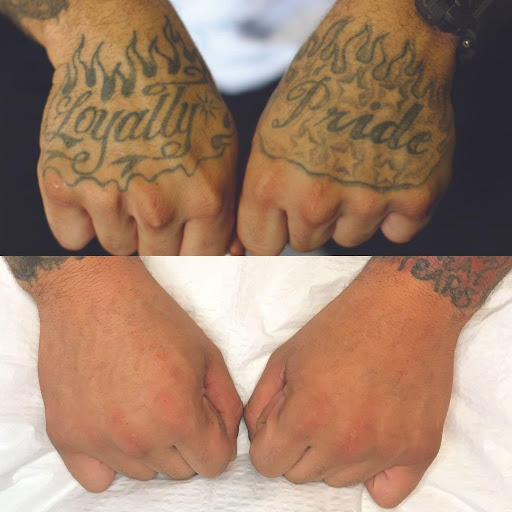Explore line work tattoo ideas, creative tattoo ideas in Glen Mills, available at Removery Tattoo Removal & Fading