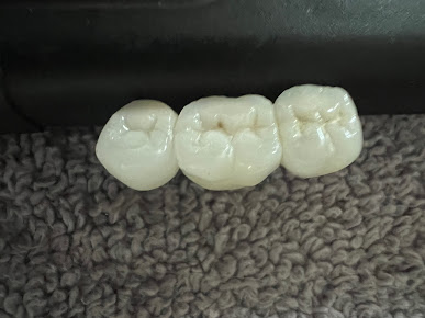 Nanodent Centre Turkey - Nanodent Centre Turkey