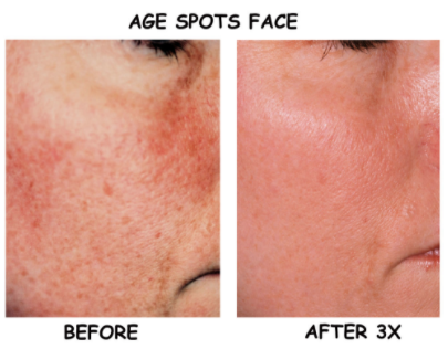 Explore league of legends tattoo ideas, creative tattoo ideas in Englewood, available at Laser Remedy Skin Solutions