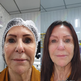 Ace Beauty Clinic - Ace Beauty Clinic