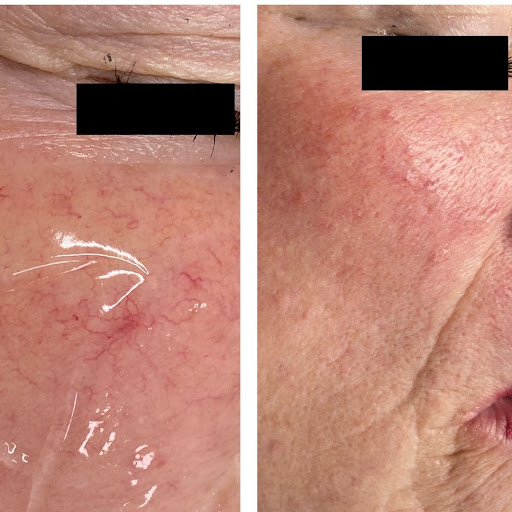 Explore r tattoo ideas, creative tattoo ideas in Lake Oswego, available at Oswego Beauty and Laser