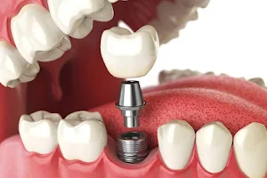 Louisville Oral Surgery & Dental Implants image