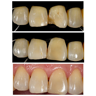 ابتسامة العناية بالأسنان سورابايا - Smile Dental Care Surabaya