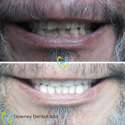 Downey Dental Arts image