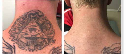 Explore dog tattoo ideas for guys, creative tattoo ideas in Longview, available at Vanish Laser Aesthetics