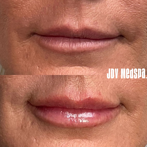 Explore back arm tattoo ideas, creative tattoo ideas in Canton, available at JDV Med Spa