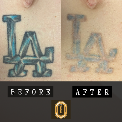Explore tattoo placement ideas, creative tattoo ideas in San Antonio, available at San Antonio Tattoo Removal Co.