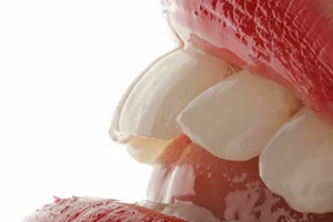ME ENCANTA MI DENTISTA Odontología Villa Urquiza Implante Ortodoncia Prótesis Extracciones Coronas Limpieza image