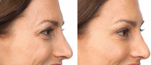 Medical Spa «VitalizeMD», reviews and photos, 57 E Main St #209, Westborough, MA 01581, USA