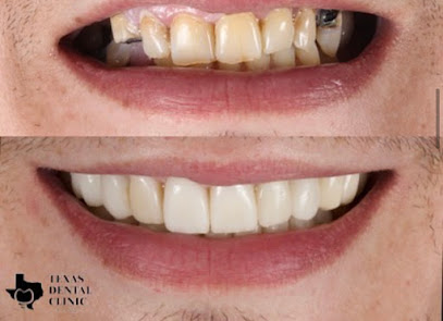 Dental implants & cosmetic dentistry by Texas Dental Clinic