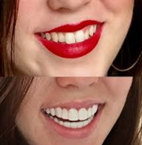Comments and reviews of Denture Cosmetics + Instant White Smile