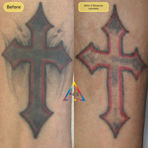 Explore magnolia tattoo ideas, creative tattoo ideas in New York, available at Ag2g Laser Tattoo Removal & MedSpa