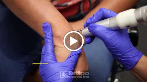 Explore tattoo ideas asian, creative tattoo ideas in South Gate, available at Tattoo Removal Inc