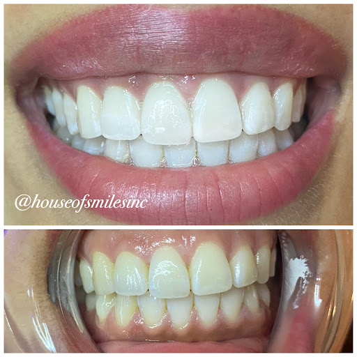 House of Smiles Teeth Whitening Inc.