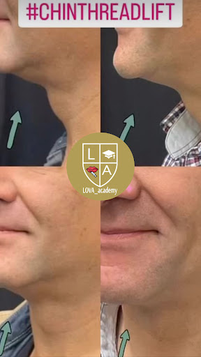 Explore luigi tattoo ideas, creative tattoo ideas in Lake Oswego, available at Lake Oswego Vein and Aesthetic LOVA