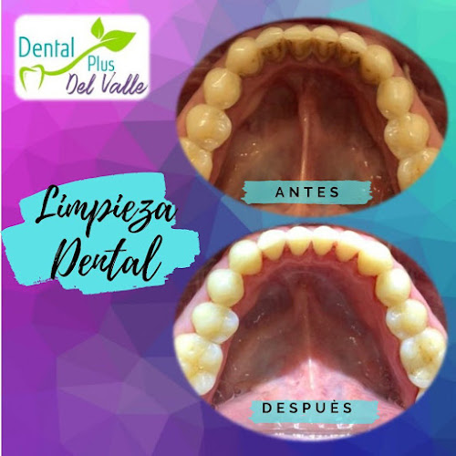 Clínica dental y Estética Plus del Valle - Huechuraba