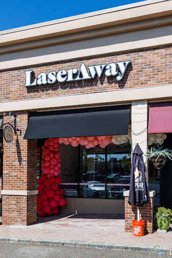 Explore mom name tattoo ideas for guys, creative tattoo ideas in Scarsdale, available at LaserAway