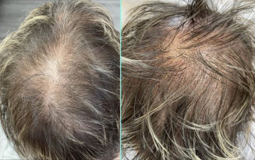 Explore good back tattoo ideas, creative tattoo ideas in Conroe, available at Institute 28