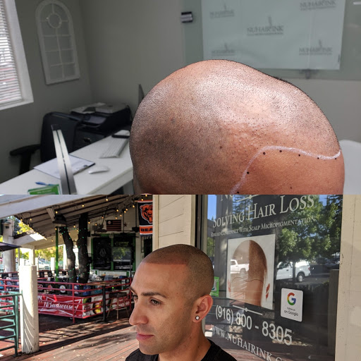 Explore anime couple tattoo ideas, creative tattoo ideas in Roseville, available at NuHair Ink. Scalp MicroPigmentation & Aesthetic Clinic of Sacramento