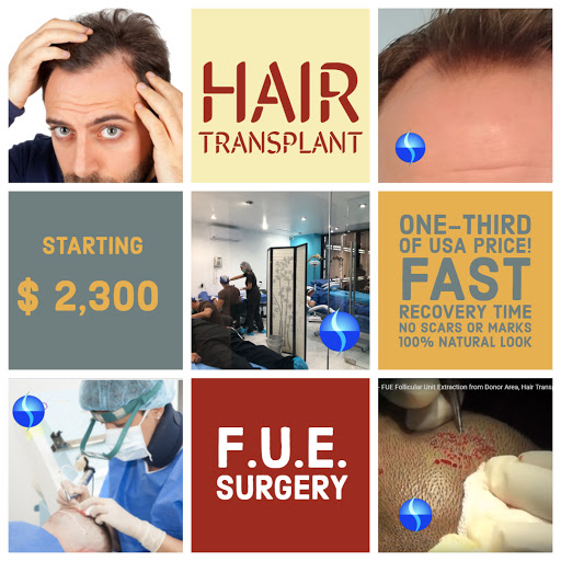 Hair Transplant Surgery in Mexico