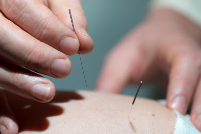 Wildwood Acupuncture