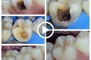 Dr Pankaj Bajaj's Smilecare Dental Clinic & Implant Centre image