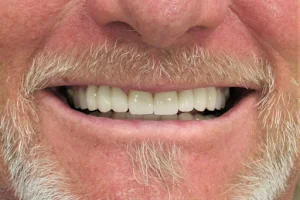Dr. Keith Sanger-Sanger Dental at the Basin image
