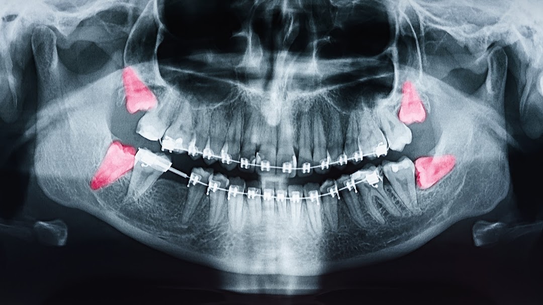 Purely Dental Surgery