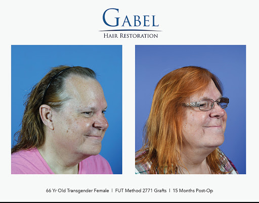 Plastic Surgeon «Gabel Center», reviews and photos, 900 SE Oak St #203, Hillsboro, OR 97123, USA