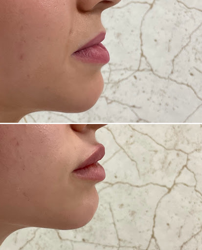 Explore ovarian cancer tattoo ideas, creative tattoo ideas in Owensboro, available at The Skin Lab