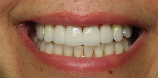 Bittner Family Dental Group image