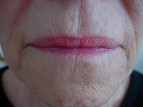 Skin to Love - Photo 2 - Car repair in Beverly Hills, CA, Los Angeles