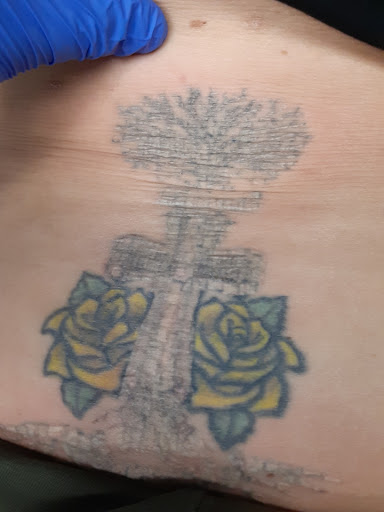 Explore daredevil tattoo ideas, creative tattoo ideas in Saint Paul, available at Fearless Tattoo Removal