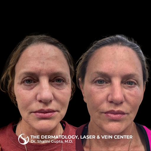 Explore leg tattoo ideas with meaning, creative tattoo ideas in Cincinnati, available at The Dermatology, Laser & Vein Center