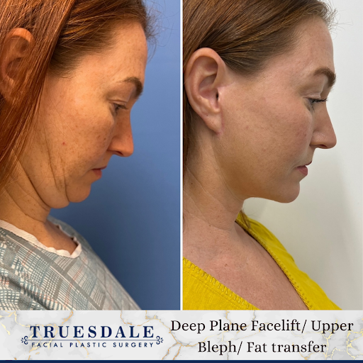 Truesdale Facial Plastic Surgery image
