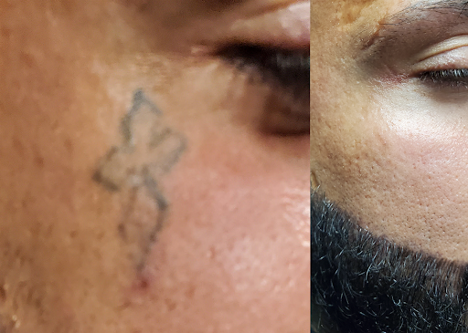 Explore tattoo family sleeve ideas, creative tattoo ideas in Rochester, available at Rochester Tattoo Removal