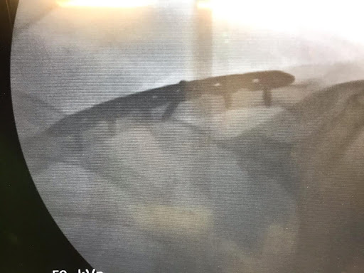 96 Kimballs Ln, Draper, UT 84020, USA