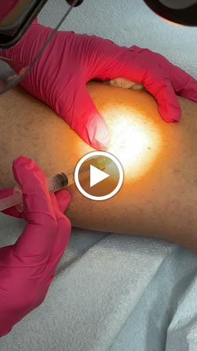 Explore jason voorhees tattoo ideas, creative tattoo ideas in Lake Oswego, available at Lake Oswego Vein and Aesthetic LOVA