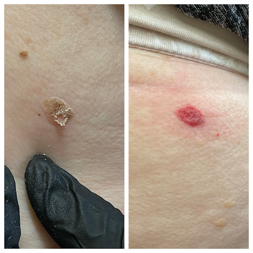 Explore anatomy tattoo ideas, creative tattoo ideas in Green Bay, available at Endless Expansion Custom Tattoo LLC & Alyssa Marie Paramedical & Areola Tattoos