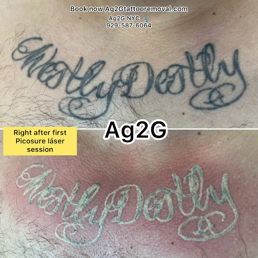Explore party tattoo ideas, creative tattoo ideas in New York, available at Ag2g Laser Tattoo Removal & MedSpa