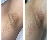 Golden Touch Electrolysis - Photo 3 - Car repair in Orange, CA, Anaheim