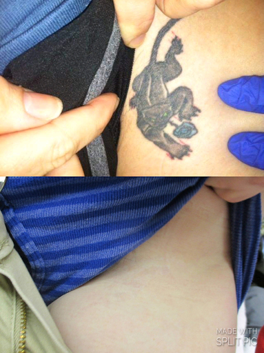 Explore space sleeve tattoo ideas, creative tattoo ideas in Houston, available at Houston Tattoo Removal Clinic