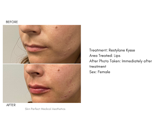 Skin Perfect Medical Aesthetics - Rancho Cucamonga image