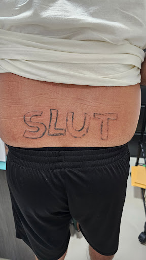 Explore bear tattoos ideas, creative tattoo ideas in Conroe, available at Removery Tattoo Removal & Fading