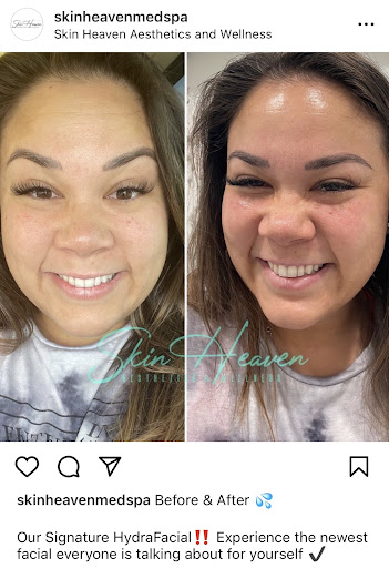 Skin Heaven Aesthetics and Wellness image