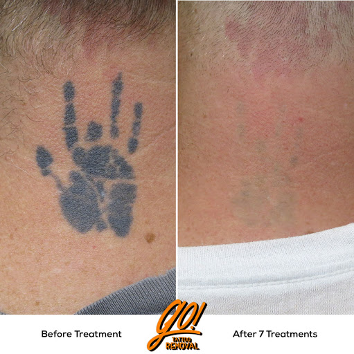 Explore knowledge tattoo ideas, creative tattoo ideas in Allentown, available at Removery Tattoo Removal & Fading